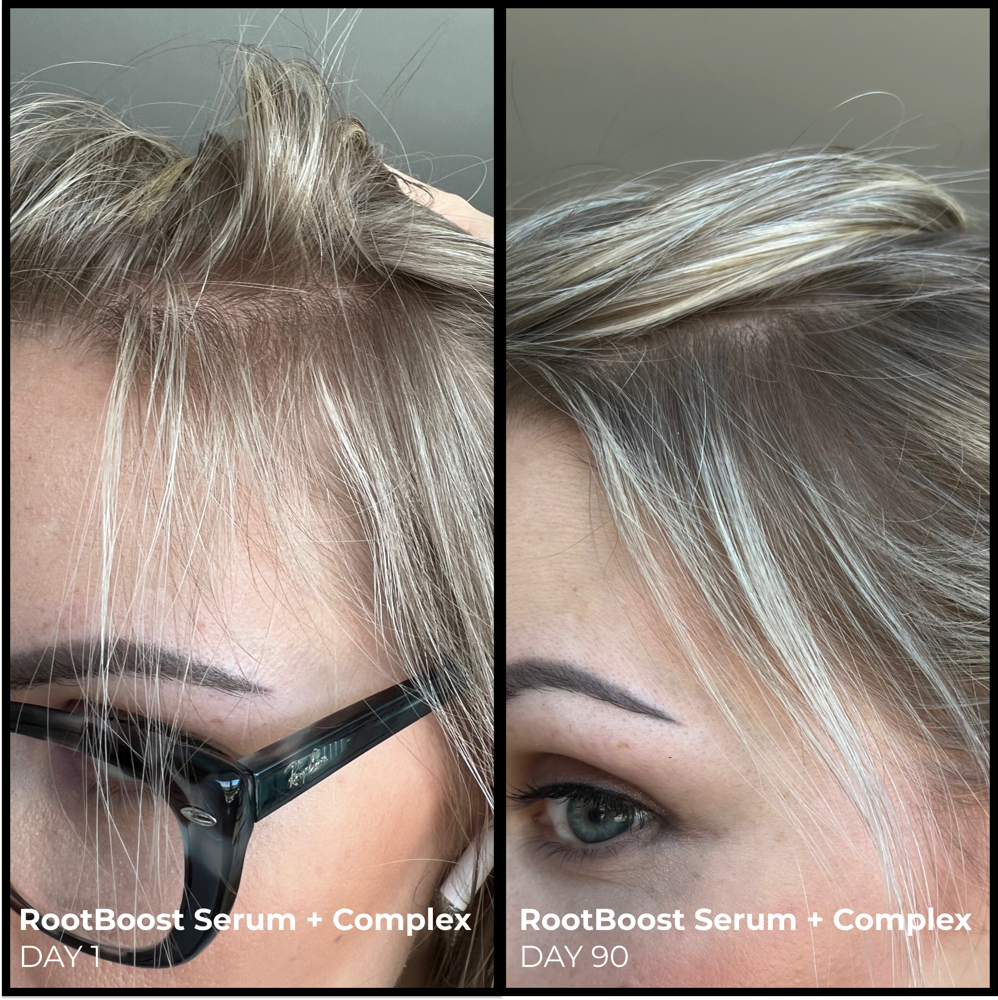 EVOLVh Better Roots System