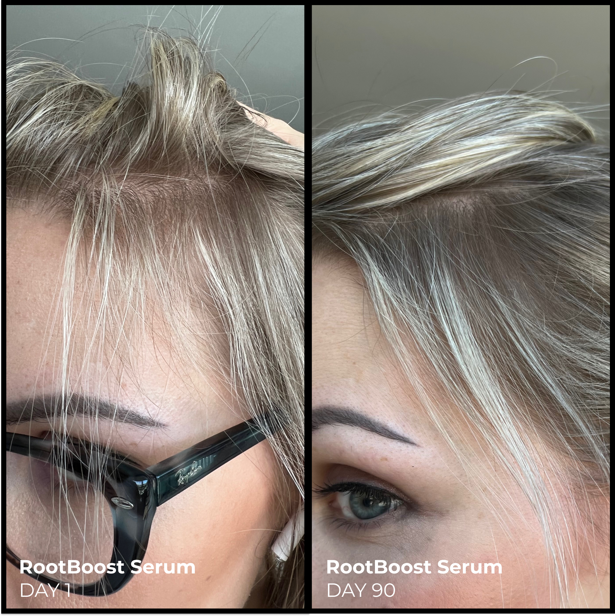 EVOLVh Better Roots Serum + Complex Duo